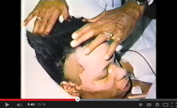 1985 Ross Dress for Less Explodes Youtube snap 7 burn injury face Benita Harris