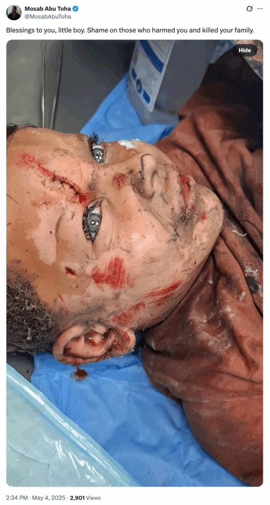 2025-05-04 Mosab Abu Toha, pulizer prize winner tweet, Blessings to you little boy. Shame on those who harmed you and killed your family. with photo of an injured, stitched up Palestinian boy, mass murdering israel now admits it intends to destroy and take all Gaza, as the non propagandized have known all along